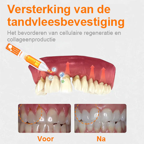 Unpree™ Tandvleesherstelbehandeling Ampullen