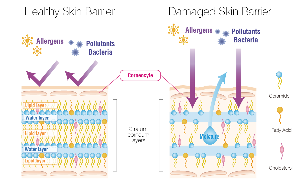 healthy skin barrier vs damaged skin barrier