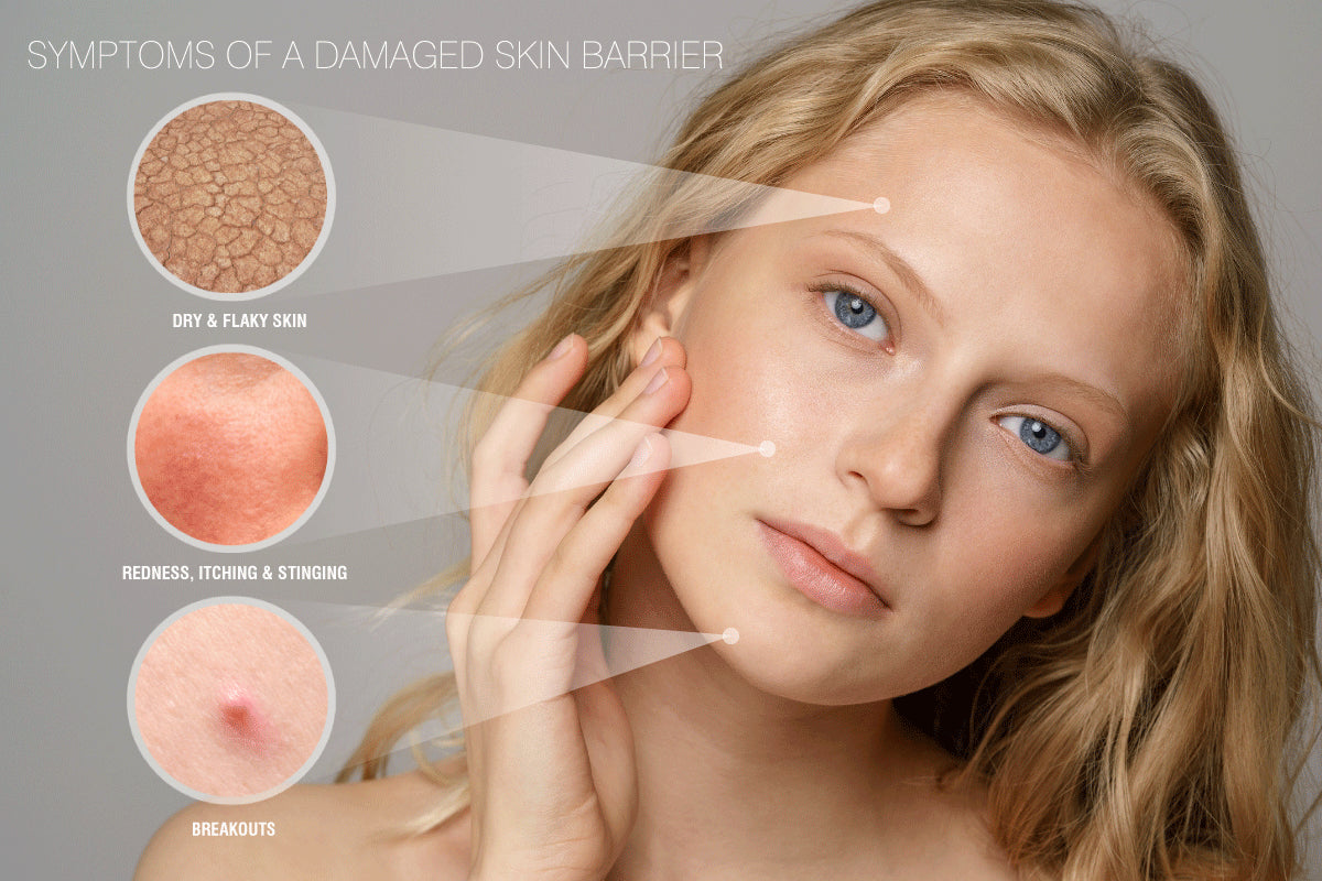 damaged skin barrier signs and symptoms