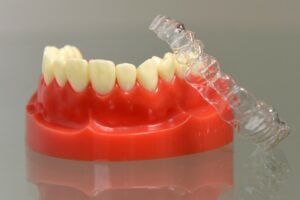 SmileFlex Single Arch - AlignerCo Spain product image