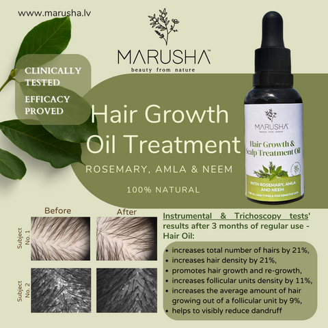 Rosemary effective and proved therapy for hair growth
