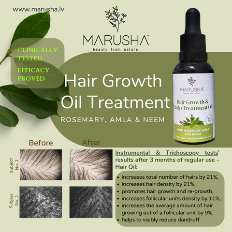 Hair growth oil