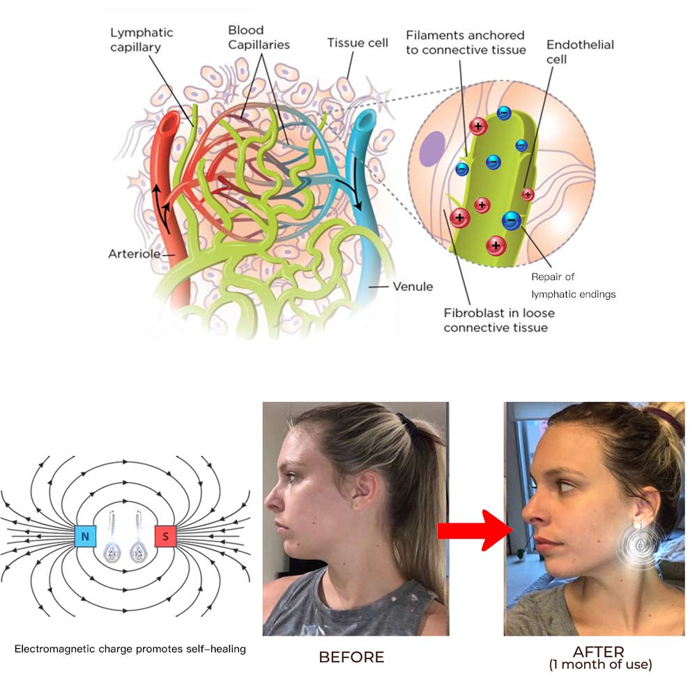 BLUESKY ™ Lymphatic Magnetic Therapy Earrings