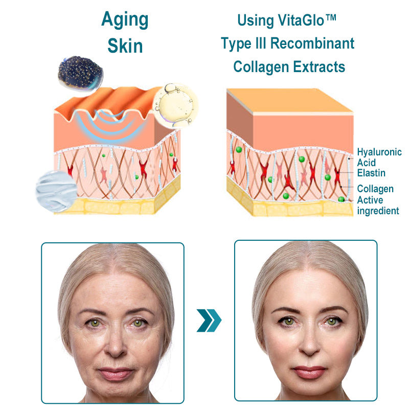 VitaGlo™ Type III Recombinant Caviar Collagen Extract + Ultrasonic Introducer