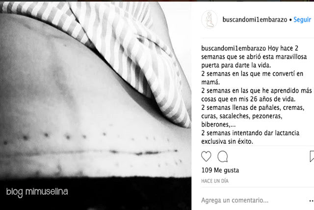 cicatriz cesárea la realidad de ser madre imagenes duras de maternidad blog mimuselina