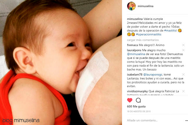 mastitis lactancia maternidad real blog mimuselina la realidad de ser madre