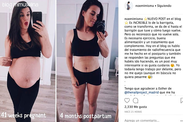 noemimisma huellas postparto embarazo blog mimuselina la realidad de ser madre. 