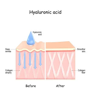 A graphic showing the before and after effects of using hyaluronic acid for skincare