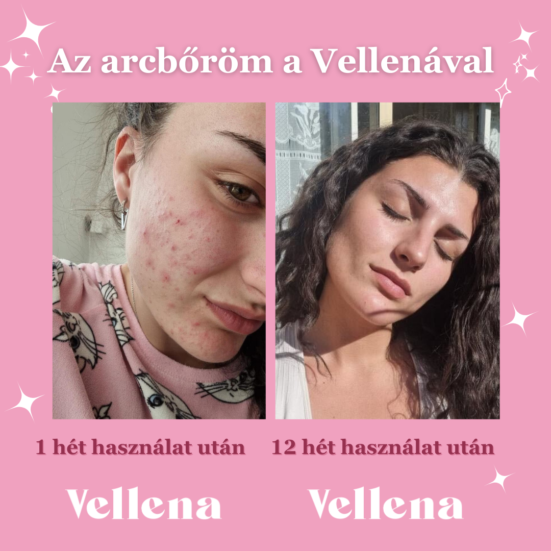 vellena vevő