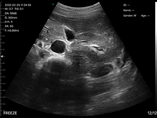 drsono-portable-ultrasound-scanner-192e-hd-images-13__PID:c25fd660-a918-4c7b-805b-73d481e6dd4d