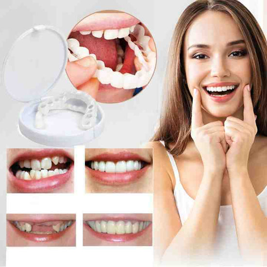 🎉Last Days 58%OFF 🎉Snap-On Dentures – uber7