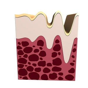 collagen