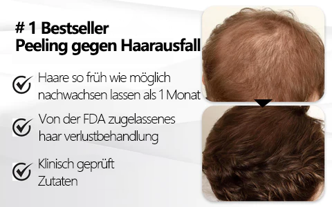 Fivfivgo™ Prestige Strand Haarwachstum สครับ