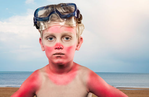 soleil rouge plage garçon peau été coup de soleil