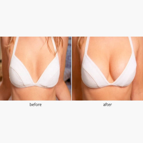 TUMMY TUCK 100ml - Freeze Frame – Freezeframe