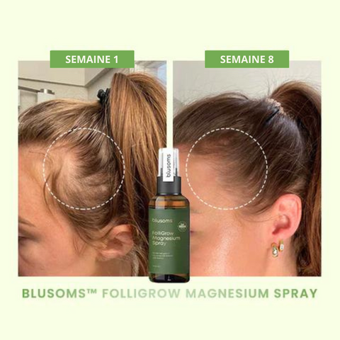 Spray pousse cheveux au Magnesium
