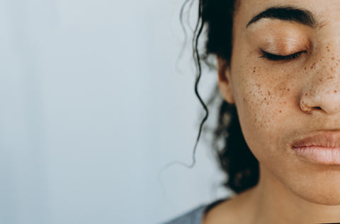 Skincare FAQs on skincare concerns like acne and hyperpigmentation