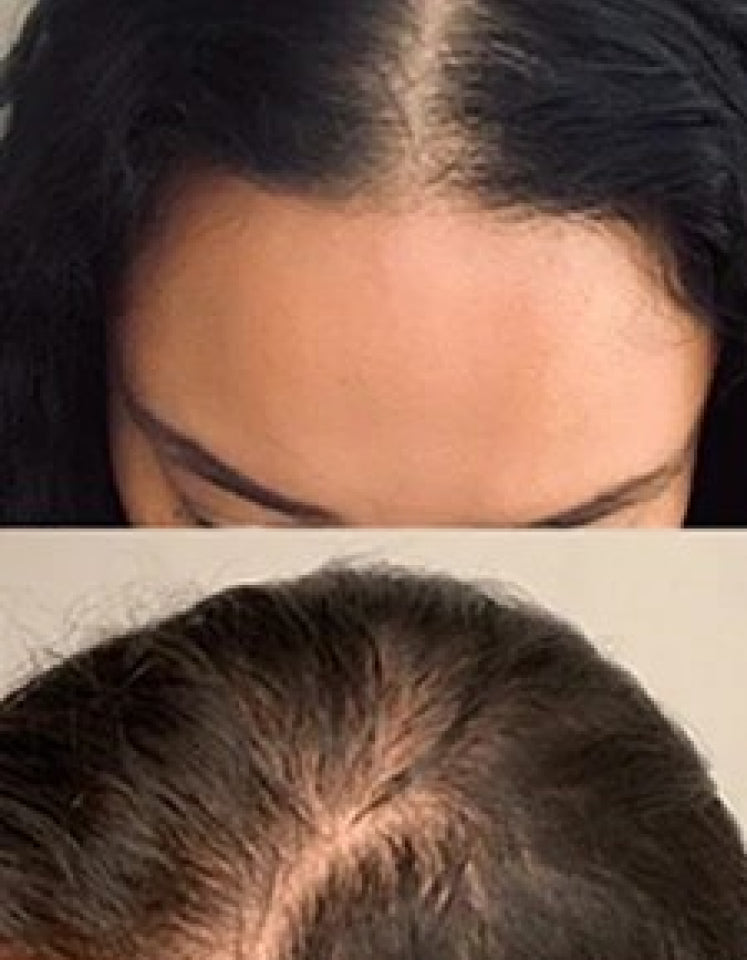Split image showing two views of a person's hairline and parting.