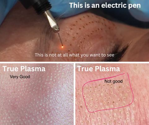 True plasma vs electric pen