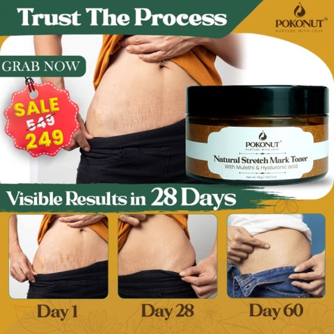 POKONUT Stretch Marks Cream