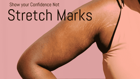 Stretch mark on the arms, chest