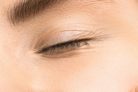 What causes wrinkles, and can they be prevented?