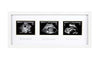 Picture of Pearhead Trimester Progression Sonogram Picture Frame, Pregnancy Milestone Keepsake Photo Frame, Sonogram Keepsake, Gender-Neutral Baby Nursery Décor