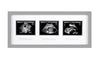Picture of Pearhead Triple Sonogram Picture Frame, Pregnancy Keepsake Photo Frame, Gender-Neutral Baby Nursery Décor