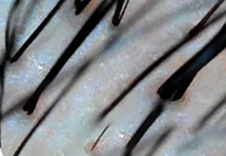 マイクロナノバブルシャワーヘッド毛穴の汚れ落ち実験の結果