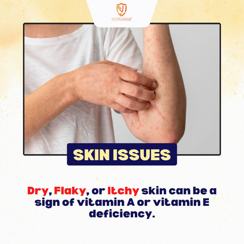 Skin Issues, Dry skin, Itchy skin, flakey skin, deficiency of vitamin A and E