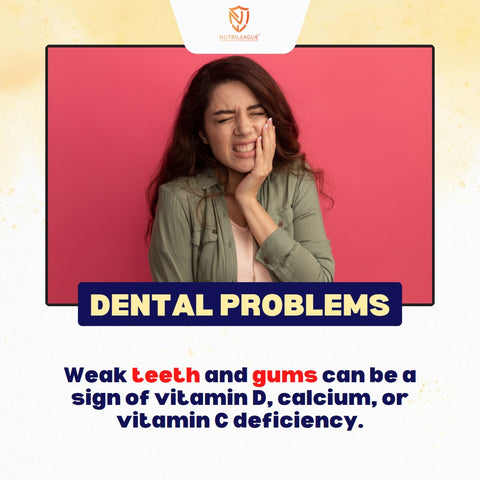 Dental Problems, Weak teeth, weak gums, lack of vitamin D and calcium