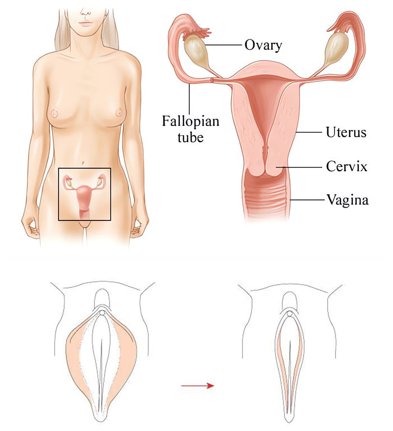 FemiPure™ Natural Vaginal Repair Gel