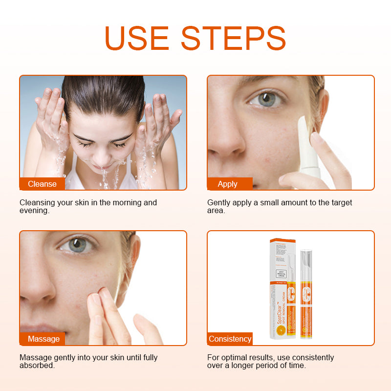 SpotClear™ Spot Removal Cream