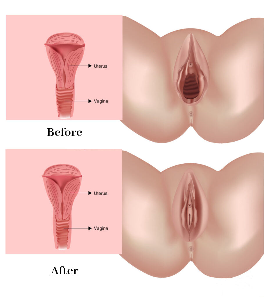 FemiPure™ Natural Vaginal Repair Gel