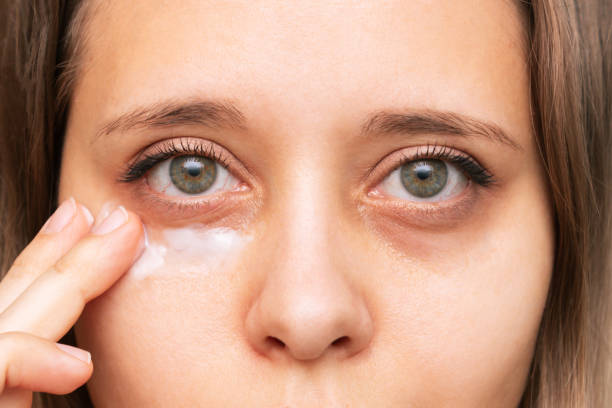 Face Creams for Dark Circles: How UAE Residents Can Benefit