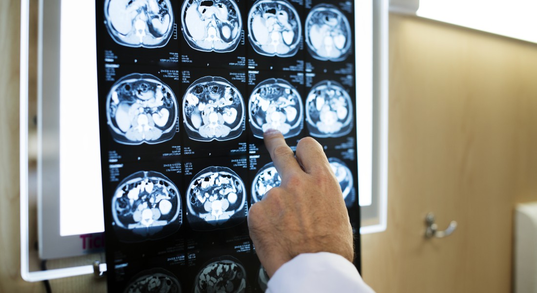 Brain Scan