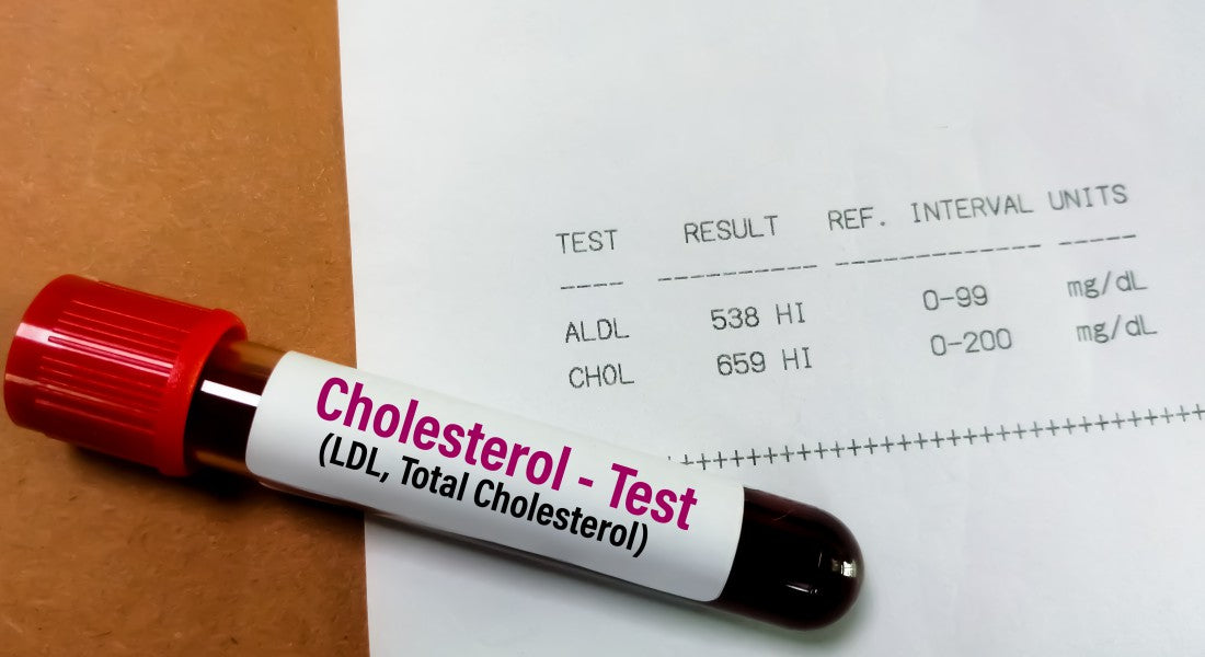 Cholesterol