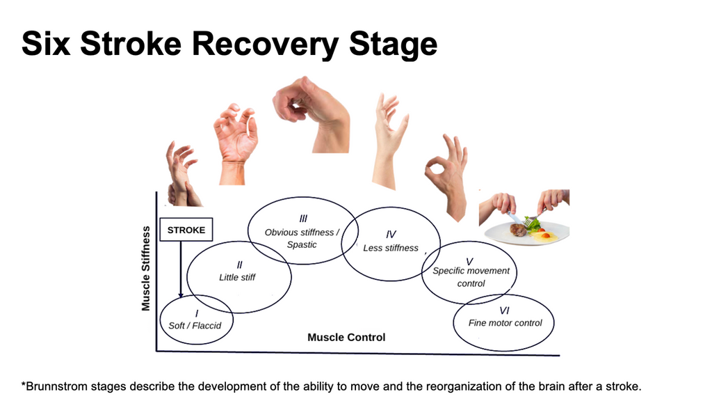 6 Stages of Hand Recovery Post-Stroke (Brunnstrom Stages of Stroke Recovery) Hand recovery after a stroke is a complex process that typically progresses through several stages. These stages reflect the body's natural healing process and the brain's ability to reorganize itself, known as neuroplasticity. Here's a breakdown of the stages: