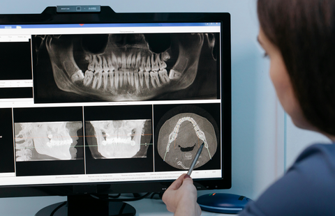 Dental Implants: Types, Procedures And How They Work - DocAlb Dental Tourism Agency Tirana Albania