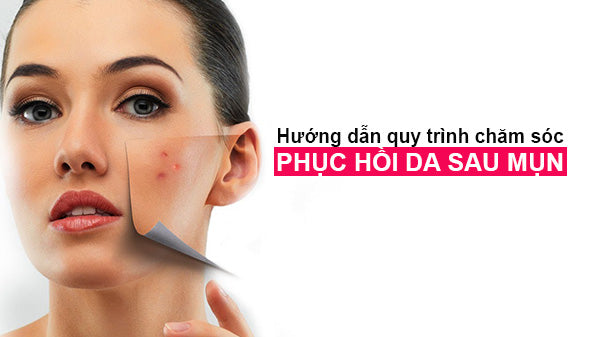 phục hồi da sau mụn, các bước phục hồi da