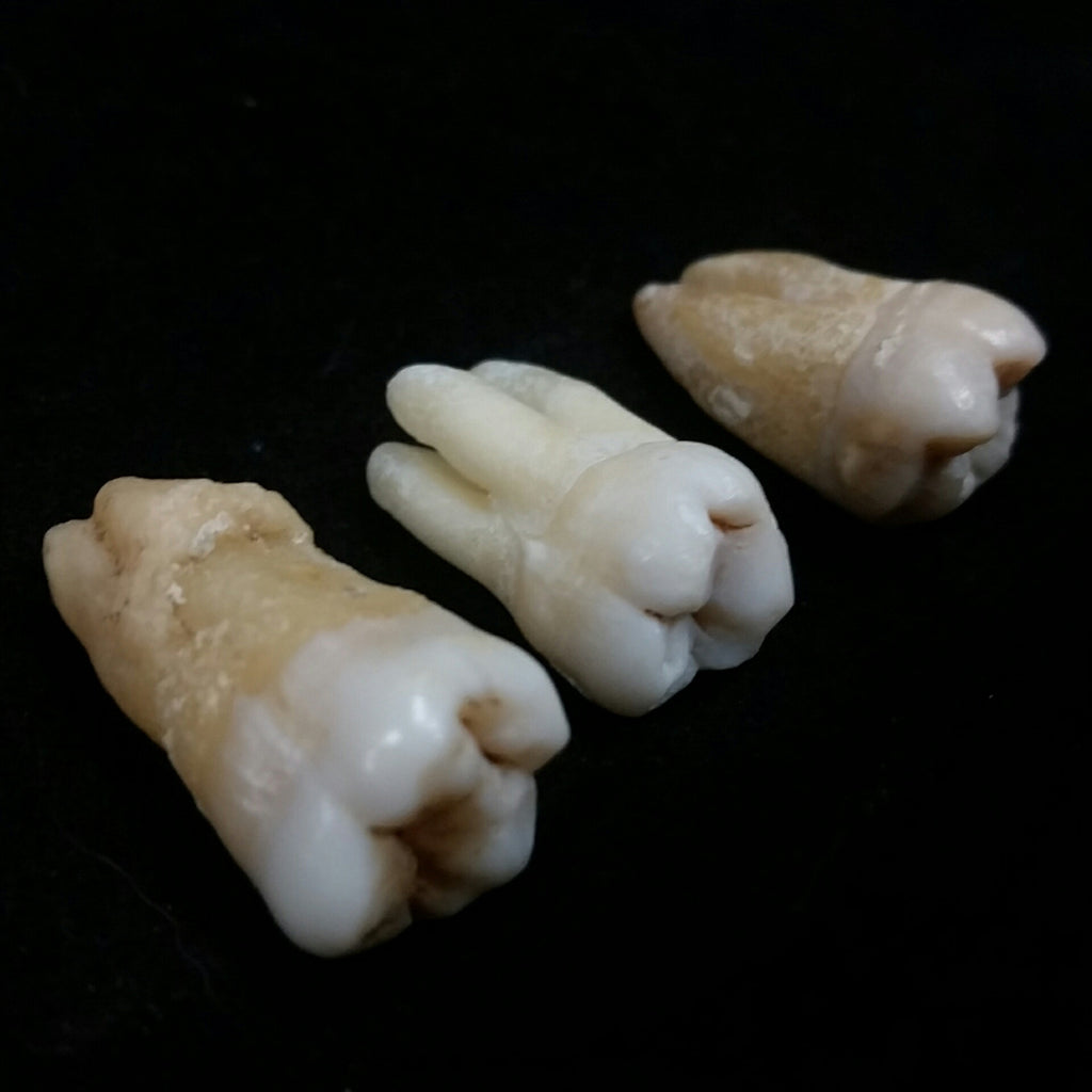 molar teeth