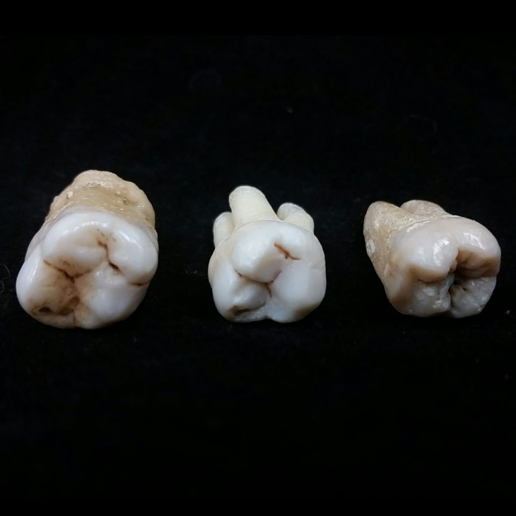 molar tooth
