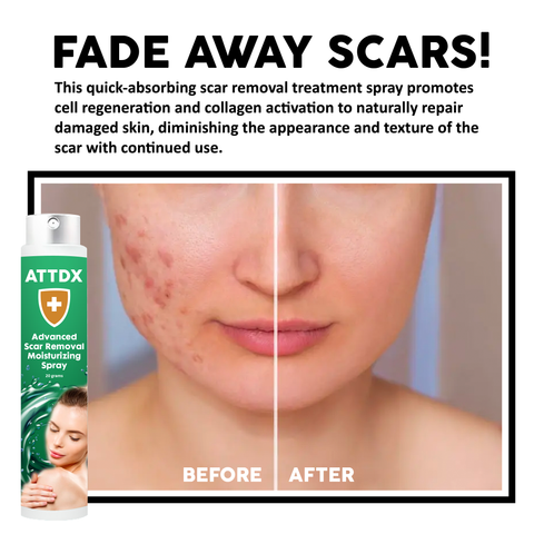 ATTDX Advanced ScarRemoval Moisturizing Spray