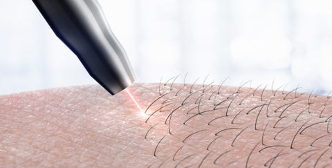 How To Shedding Hair After Laser Hair Removal