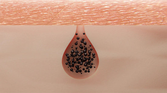 Graphic of a comedone, aka a clogged pore