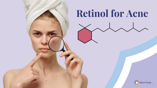 Retinol for acne