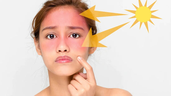 Retinol Sun Sensitivity and Photosensitivity