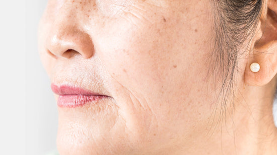 What Are The Causes of Aging Skin?
