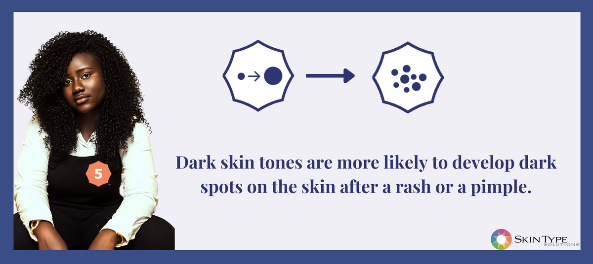 Inflammation Causes Hyperpigmentation and Makes the Skin Turn Darker ...