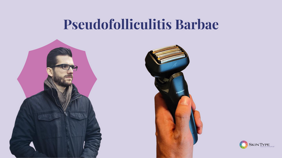 Pseudofolliculitis Barbae